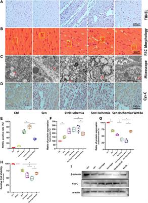 Wnt 3a Protects Myocardial Injury in Elderly Acute Myocardial Infarction by Inhibiting Serum Cystatin C/ROS-Induced Mitochondrial Damage